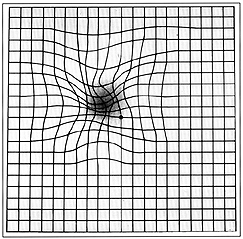 Imagen distorsionada en pacientes con degeneraci�n macular