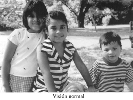 Visi�n Normal.